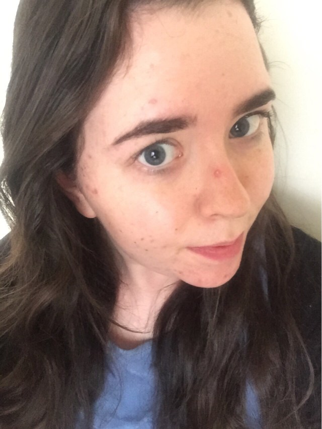elf acne fighting foundation review before and after